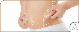 Laser Fat Removal Treatment Near Me in Saint Clair Shores, MI Laser Fat Removal Treatment Near Me in Saint Clair Shores, MI