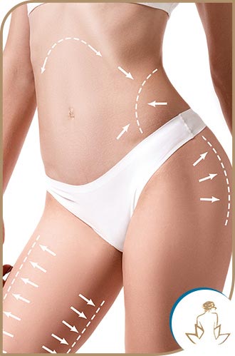 Smart Lipo in Saint Clair Shores, MI