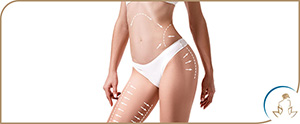 Smart Lipo: Frequently Asked Questions in Saint Clair Shores, MI Smart Lipo: Frequently Asked Questions in Saint Clair Shores, MI