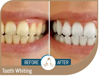 Before and After Gallery of True Laser Spa in Saint Clair Shores, MI Before and After Gallery of True Laser Spa in Saint Clair Shores, MI