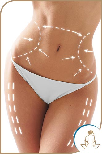 Zerona Fat Removal in Saint Clair Shores, MI