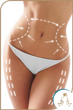 Zerona Fat Removal in Saint Clair Shores, MI