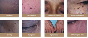 Perfect Touch Procedure Near Me in Saint Clair Shores, MI Perfect Touch Procedure Near Me in Saint Clair Shores, MI