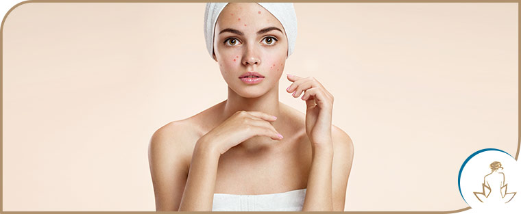 AviClear for Acne Treatment Near Me in Saint Clair Shores, MI AviClear for Acne Treatment Near Me in Saint Clair Shores, MI