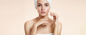 AviClear for Acne Treatment Near Me in Saint Clair Shores, MI