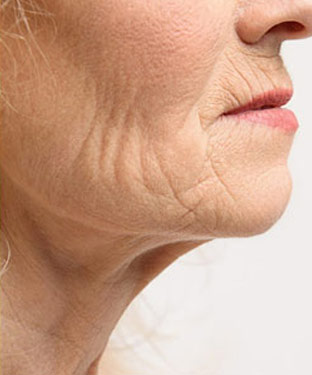 Electrolysis Hair Removal in Saint Clair Shores, MI