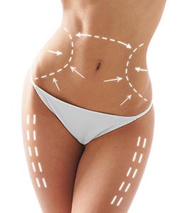 Zerona Fat Removal in Saint Clair Shores, MI