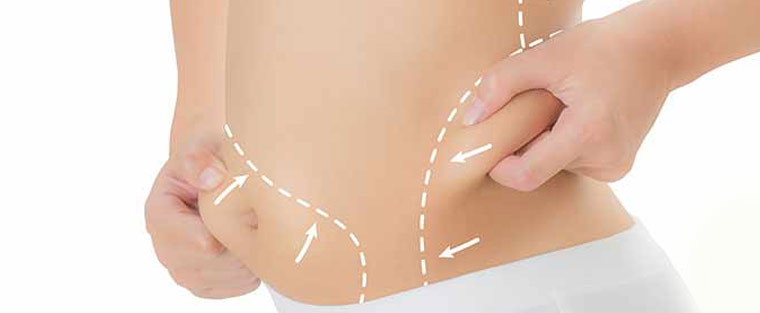 Laser Fat Removal Treatment Near Me in Saint Clair Shores, MI