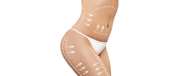 What Is Liposuction – An Introductory Guide Near Me in Saint Clair Shores, MI