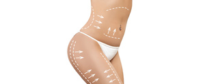 What Is Liposuction – An Introductory Guide Near Me in Saint Clair Shores, MI