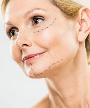 Microneedling Treatment in Saint Clair Shores, MI