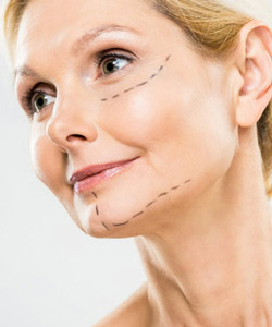 Microneedling Treatment in Saint Clair Shores, MI