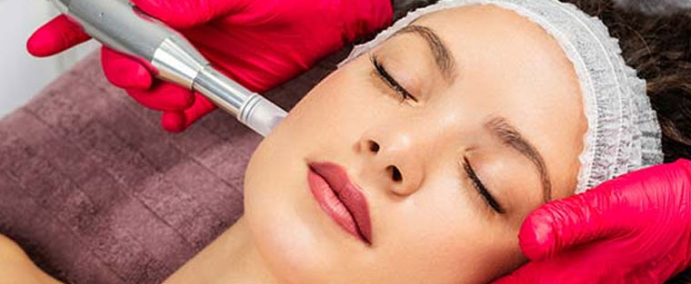 RF Microneedling Treatment Near Me in Saint Clair Shores, MI