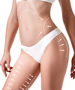 Smart Lipo in Saint Clair Shores, MI