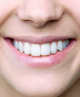 Teeth Whitening Near Me in Saint Clair Shores, MI