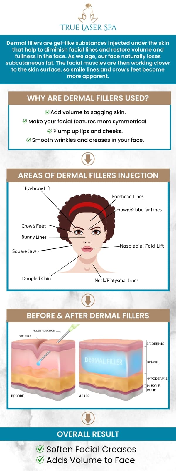 Dermal fillers fill in wrinkles, smooth lines, and add volume to your face. These compounds are injected directly beneath your skin by your healthcare professional. People prefer dermal fillers to enhance their facial characteristics or to look more youthful. Get rid of wrinkles with our cosmetic dermal fillers at True Laser Spa. Contact us for more information or request an appointment online. We are conveniently located at 22030 Greater Mack Ave Saint Clair Shores, MI 48080.